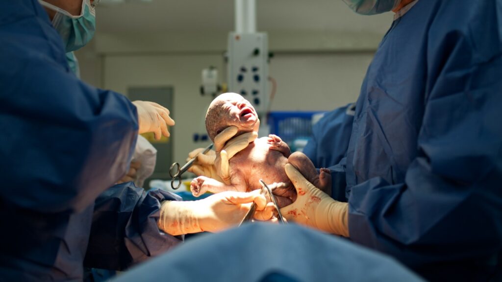 Is normal delivery better for women or caesarean delivery? Get expert advice